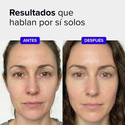 Beautybacs
